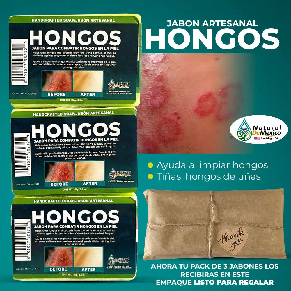 Hongos